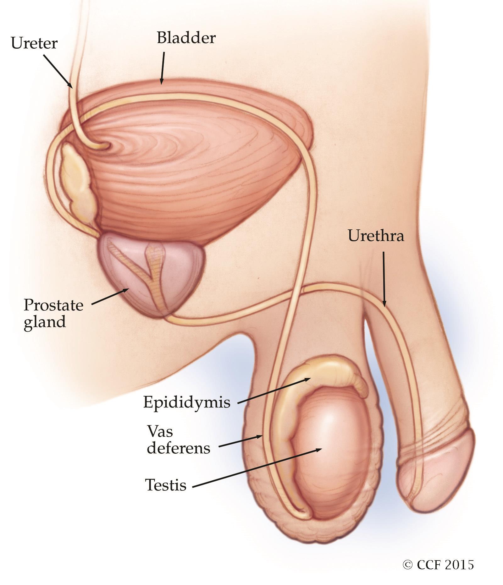 Prostatic urethral lift