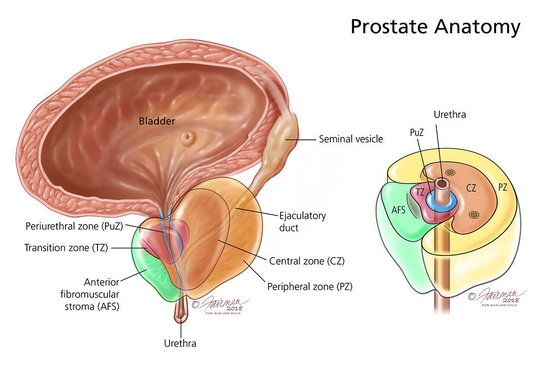 Prostatitis (Infection of the Prostate)