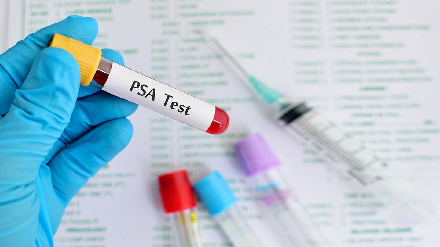 PSA Testing Rates for Prostate Cancer Have Leveled Off ...