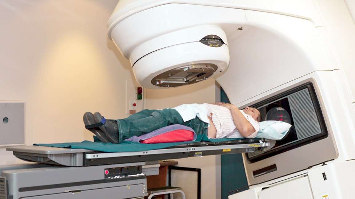 Radiation for Prostate Cancer: When Its Used, Side Effects &  More