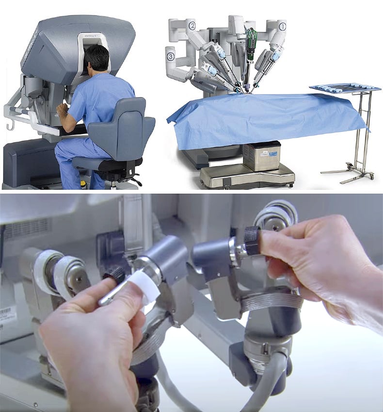 Robotic Prostate Cancer Surgery