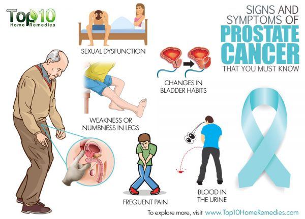 Signs and Symptoms of Prostate Cancer