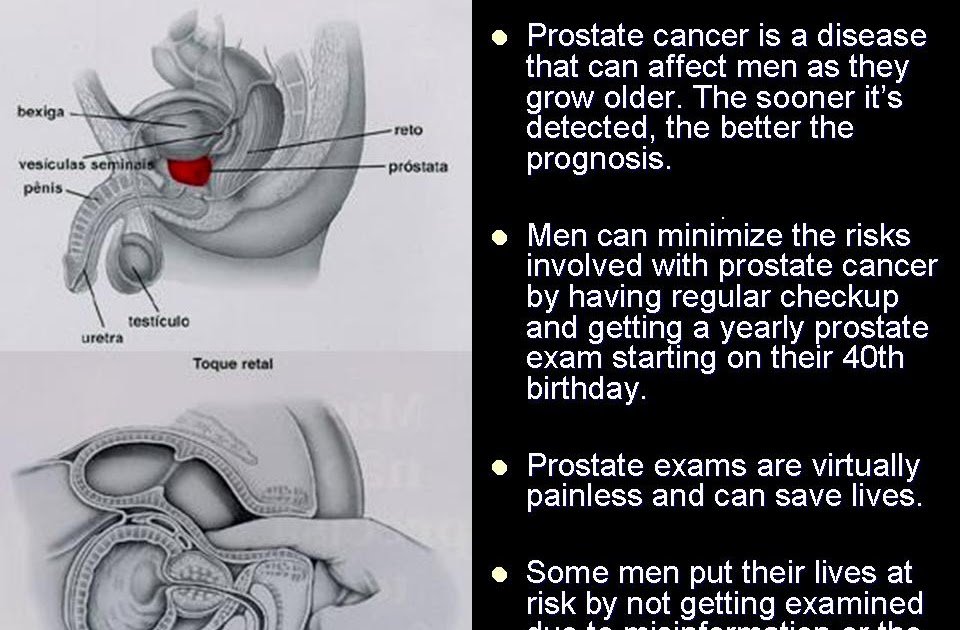 Something2Share: Prostate Check & 7 Prostate Symptoms ...