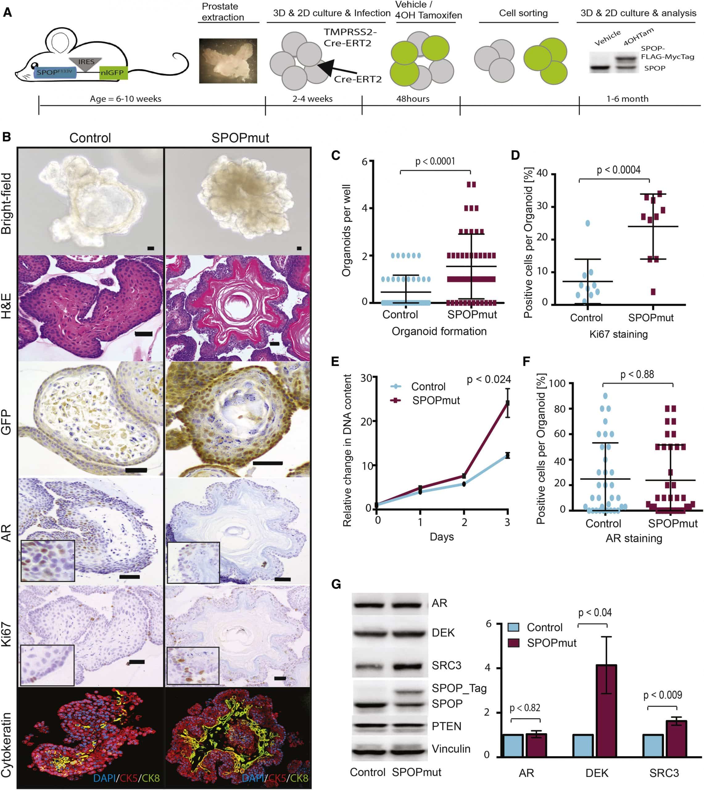 SPOP Mutation Drives Prostate Tumorigenesis In Vivo through Coordinate ...