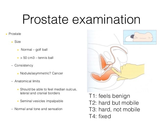Stable prostate cancer 2015