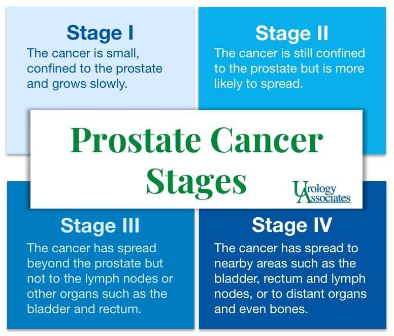 Stage 4 Prostate Cancer Spread To Bones Life Expectancy ...