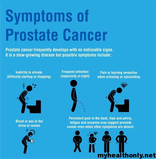 Symptoms of Prostate Cancer, Risk Factors and Causes