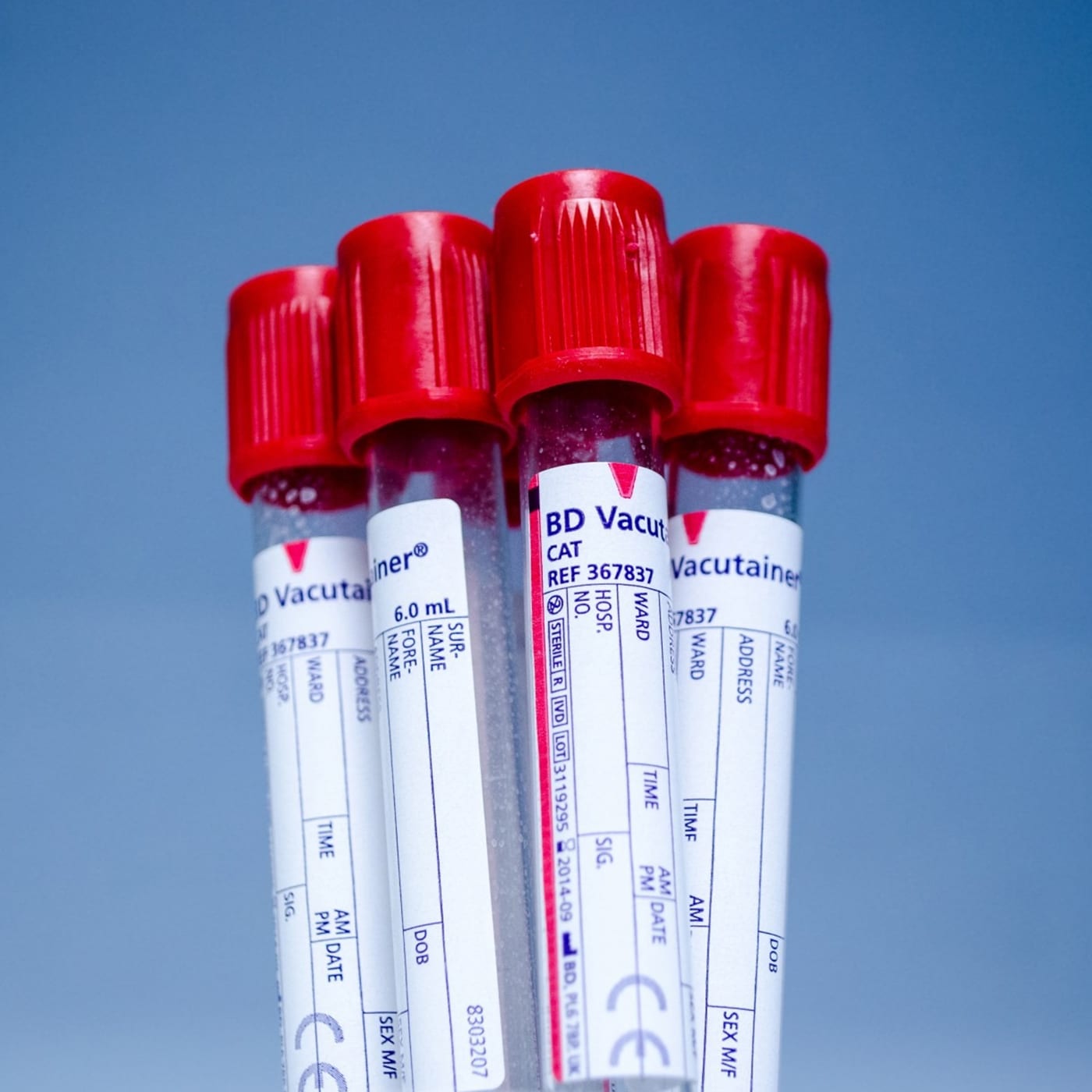 The PSA Blood Test  Why We Should Not Abandon PSA Testing