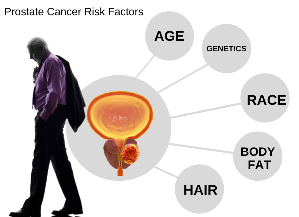 Top 5 Warning Signs &  Symptoms Of Prostate Cancer