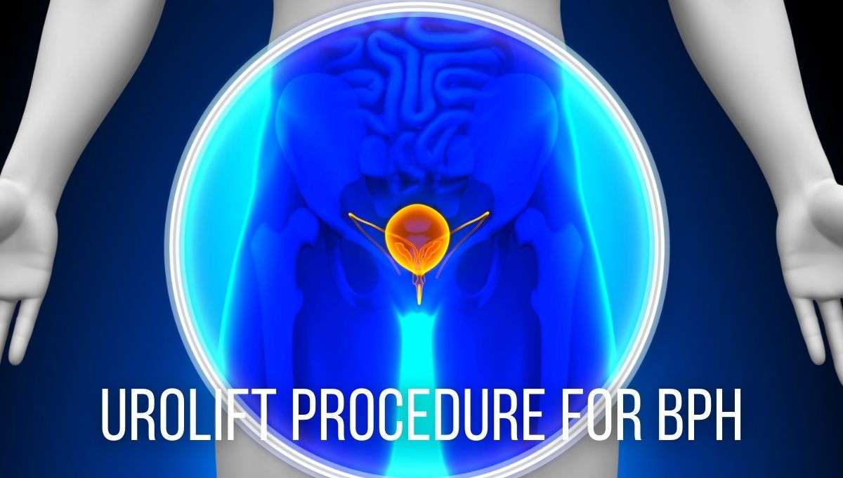 UroLift Procedure for BPH