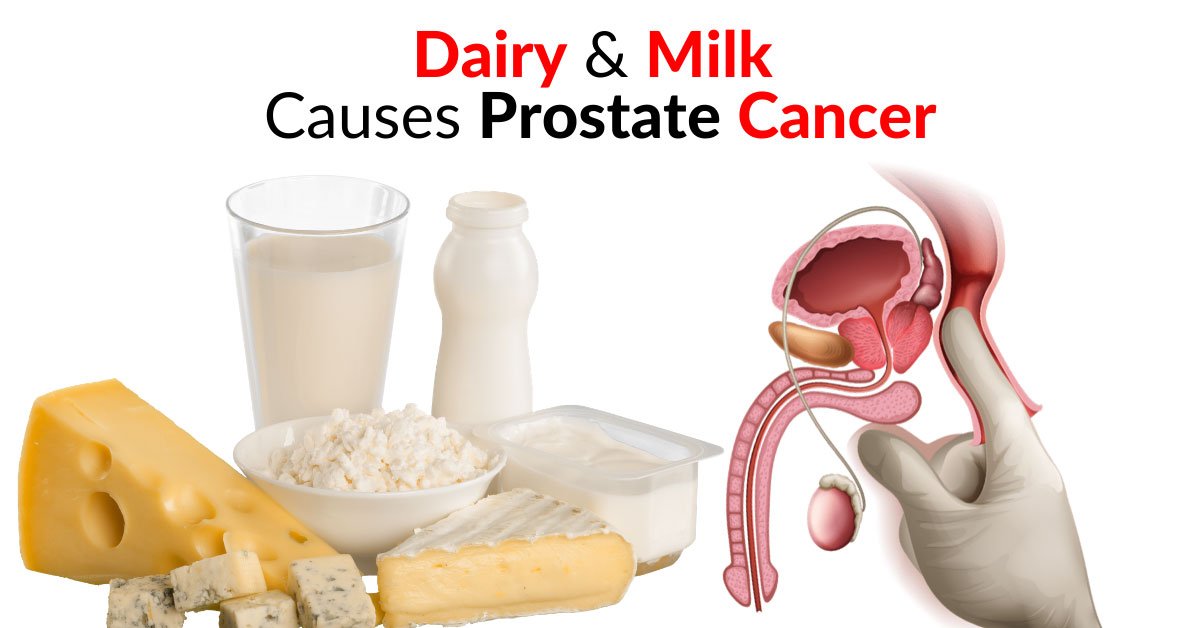 WARNING: Dairy and Milk Causes Prostate Cancer