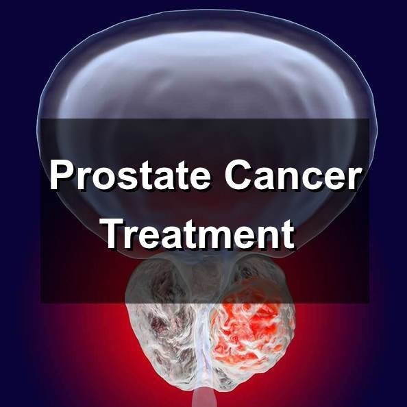 What are treatments for prostate stones?