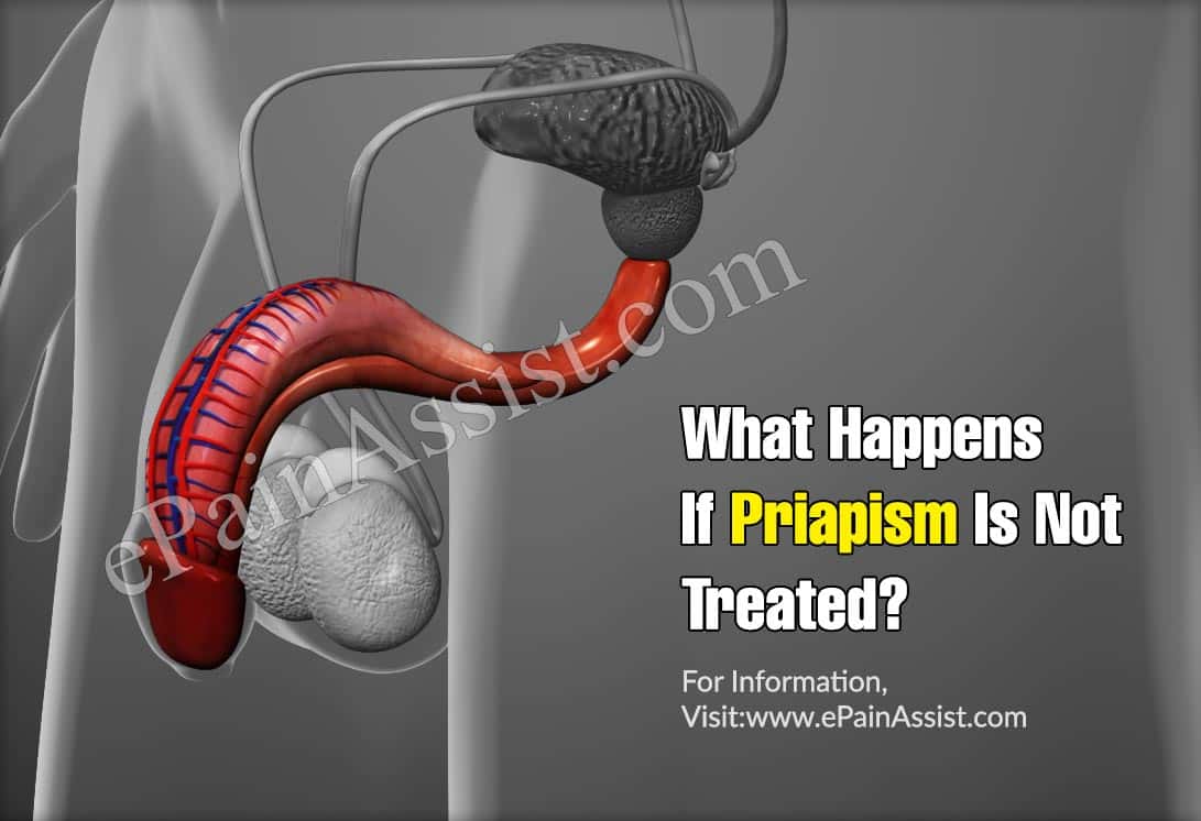 What Happens if Priapism is Not Treated?