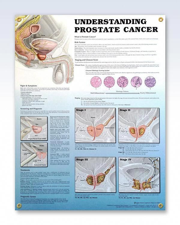What Happens In Prostate Cancer