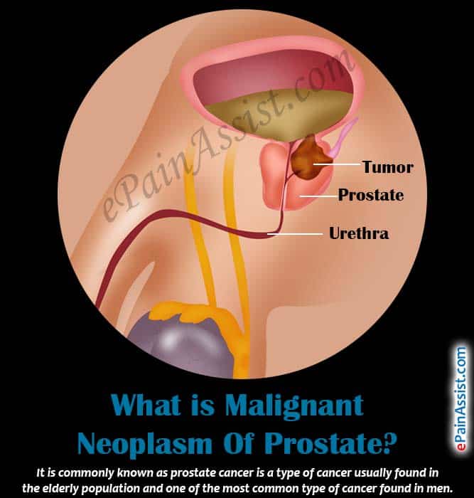 What Is Neoplasm Of Prostate