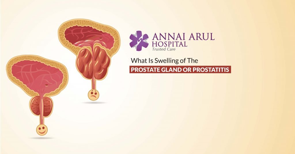 How can you tell if your prostate is swollen