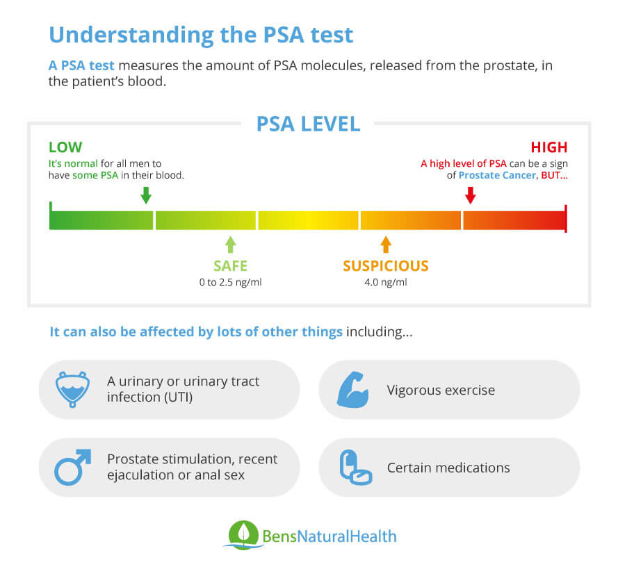 What is the PSA Level for Prostate Cancer?