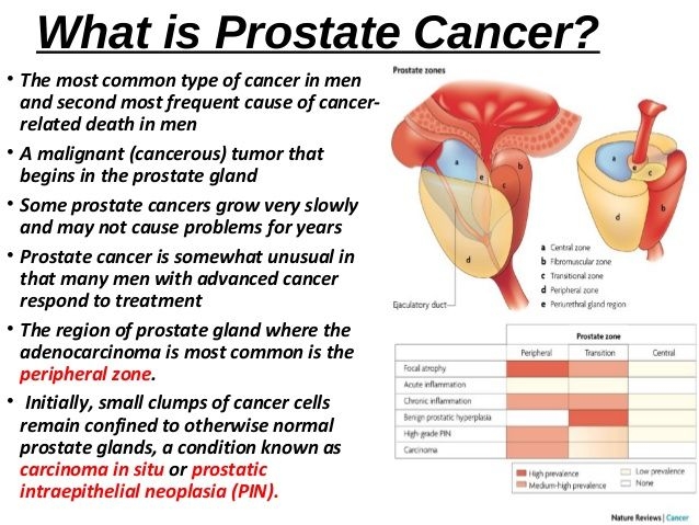 What is the most common treatment for prostate cancer
