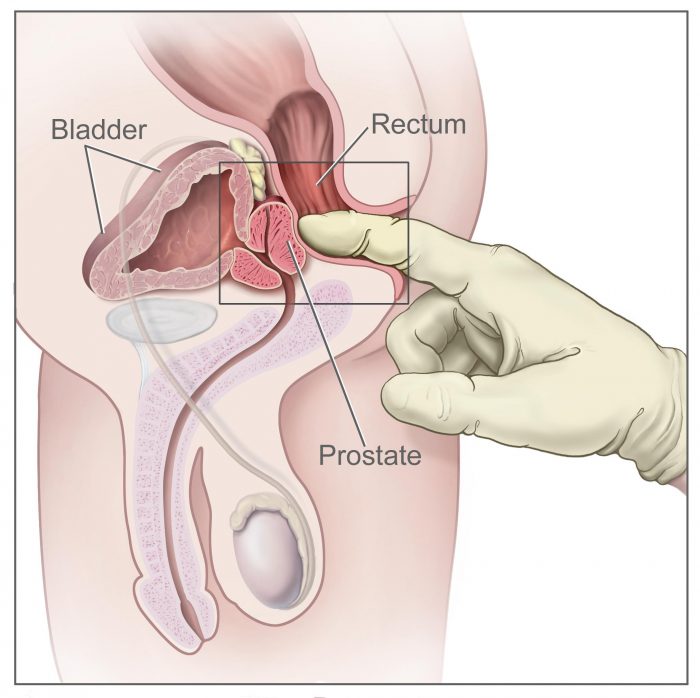 Why is the Prostate Gland named as the male version of the ...
